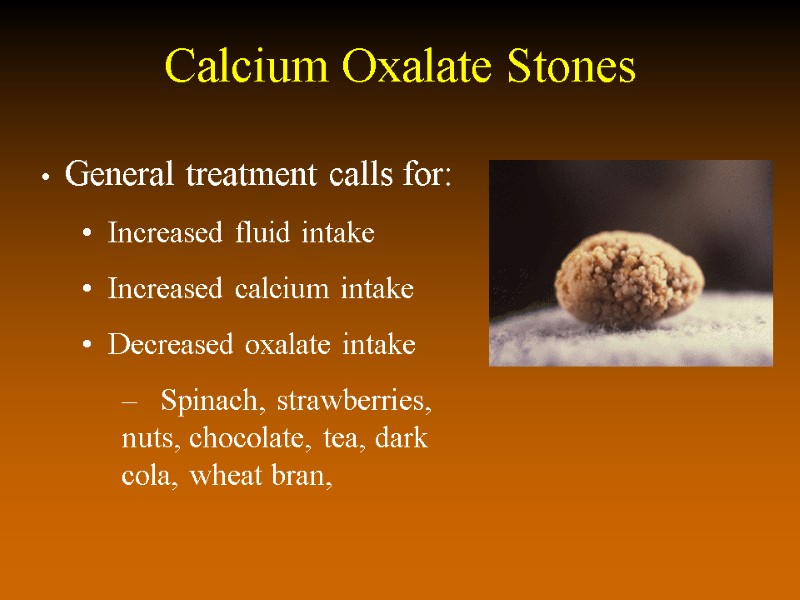 Calcium Oxalate Stones   General treatment calls for:   Increased fluid intake